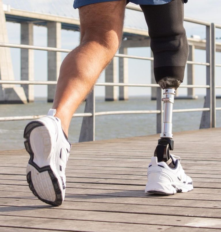 Prótesis ortopédicas personalizadas para miembros superiores e inferiores, diseñadas para recuperar movilidad, autonomía y calidad de vida.